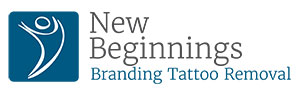 New Beginnings Branding and Tattoo Removal