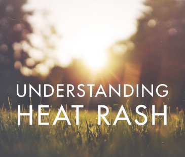 Understanding Heat Rash