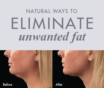 Natural Ways to Eliminate Unwanted Fat