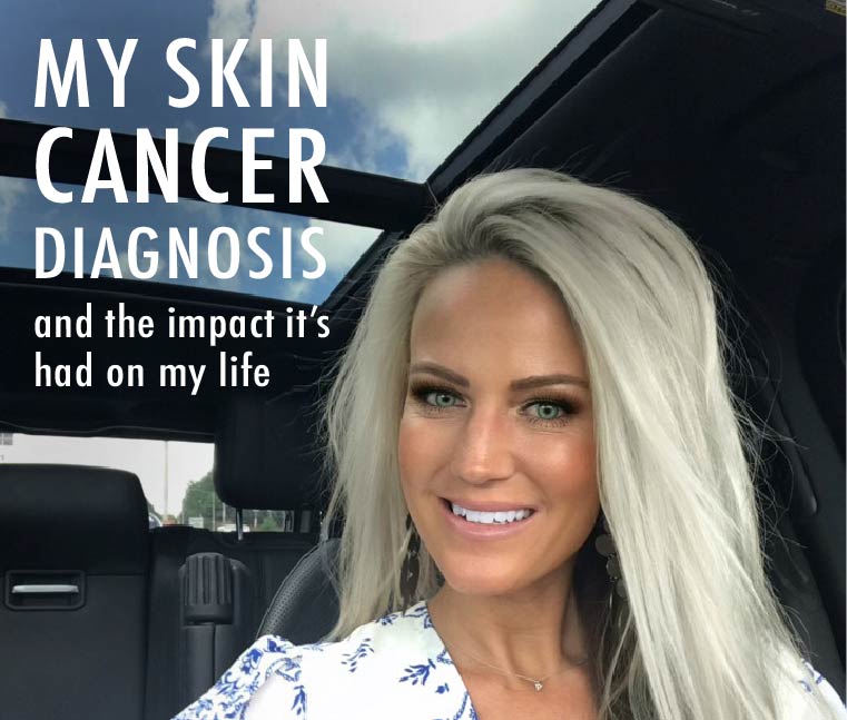 Skin Cancer Blog, Skin Wellness