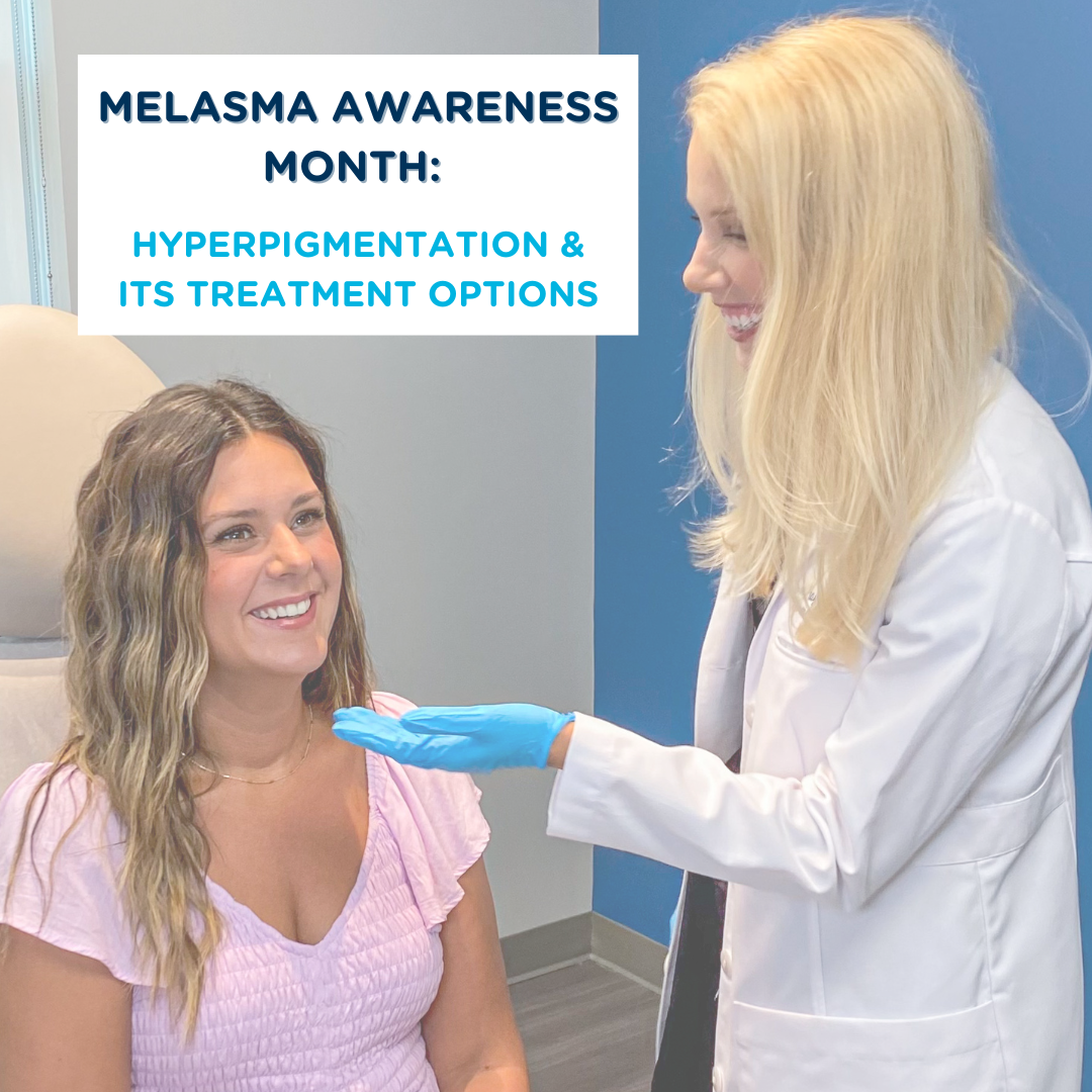Hyperpgmentation Month Melasma Awareness Month: Hyperpigmentation & Its Treatment Options ...
