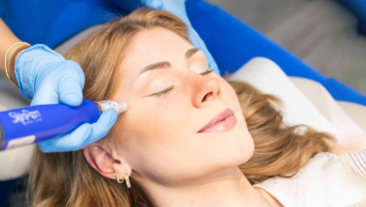 Patient receiving SkinPen microneedling near eye during cosmetic skin treatment at dermatology clinic.