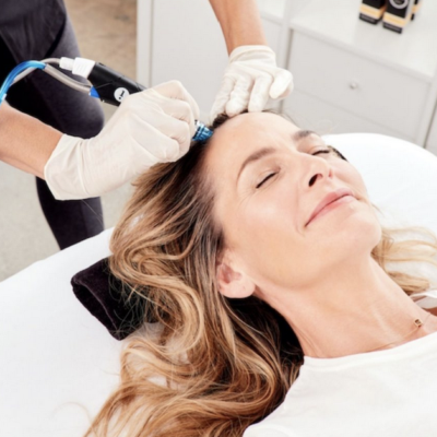 A woman relaxed receiving microneedling scalp treatment from clinician for hair rejuvenation in dermatology clinic.