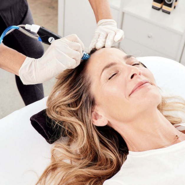 A woman relaxed receiving microneedling scalp treatment from clinician for hair rejuvenation in dermatology clinic.